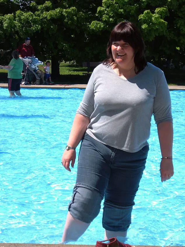 Lyn Fox, 63, Faces Knee Replacement After Decades of Weight Struggle