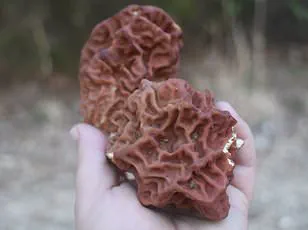 Breakthrough in Early Detection of Motor Neurone Disease: Blood Test Reveals Decade-Long Window for Intervention, Challenging Long-Held Assumptions