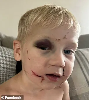 Arrest Made in Georgia Daycare Abuse Case Involving One-Year-Old; Worker Charged with Aggravated Battery