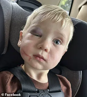 Arrest Made in Georgia Daycare Abuse Case Involving One-Year-Old; Worker Charged with Aggravated Battery