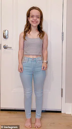 Living with Achondroplasia: Chandler Crews' Journey and the Broader Implications for Communities