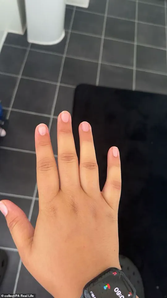 Living with a Rare Autoimmune Disease: Tia Rey's Journey Through Misdiagnosis and Unrelenting Pain