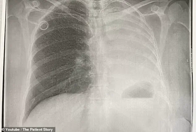 Sudden Health Crisis of USO Volunteer in Guam Sparks Discussion on Public Health Preparedness