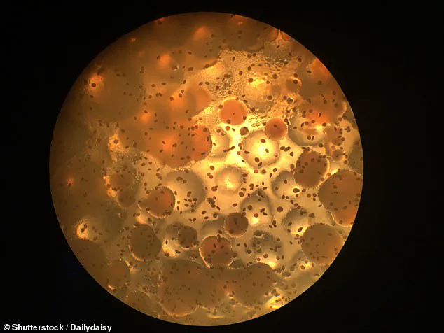 Urgent Expansion of Soap Recall: Contaminated Products Pose Severe Risk to Immunocompromised, Especially Cystic Fibrosis Patients