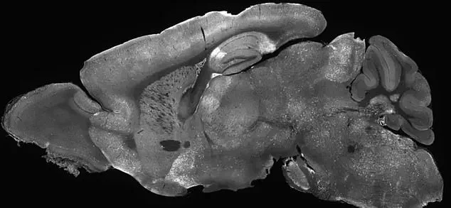 Washington State Researchers Advance Understanding of SYNGAP1-Related Disorders in Autism and Epilepsy