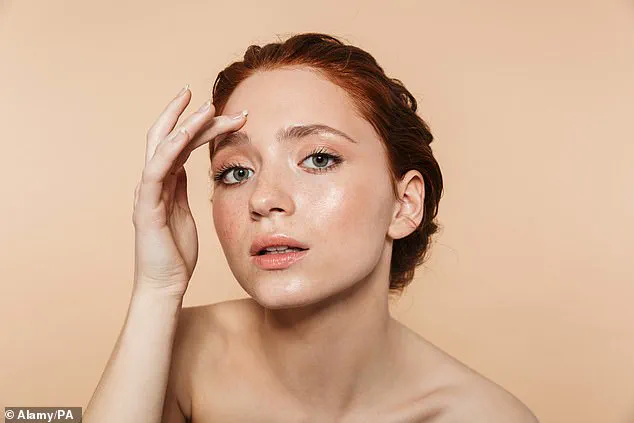 Acne in Britain: A Common Skin Condition with Significant Emotional Impact