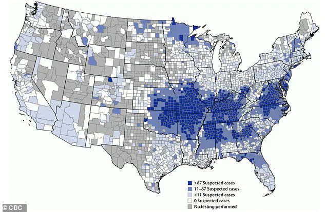 First Fatality from Rare Tick-Bite-Induced Meat Allergy Highlights Urgent Need for Awareness, Expert Advisories in *Journal of Allergy and Clinical Immunology: In Practice*