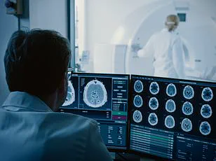 Health Experts Urge Recognition of Sundowning: Overlooked Dementia Symptom with Public Health Implications