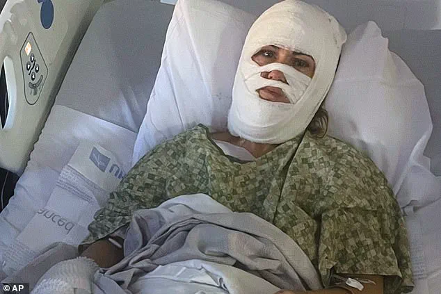 Georgia Woman Suffers Acid Attack in Savannah, Faces Disfigurement and Medical Bills