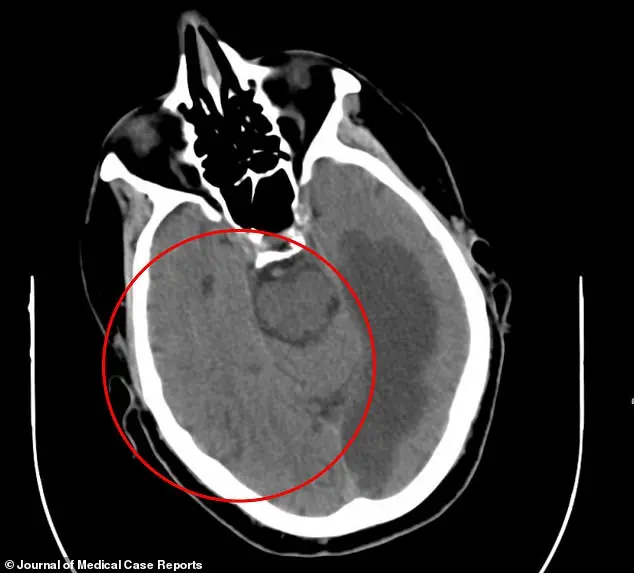 Medical Mystery in Waterford: Rare Neurological Condition Unveiled in 76-Year-Old Man's Case