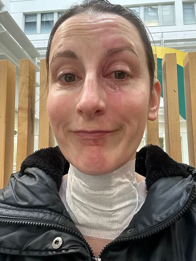 Cecily Beer: 'The Blender’s Lid Flew Off, Covering My Face in Molten Liquid – Now I May Need a Skin Graft'