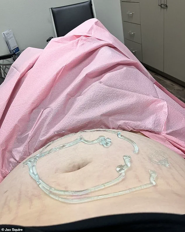 Jax Squire's Unexpected Pregnancy and Adoption Decision Highlight Transgender Parenting Challenges in Texas