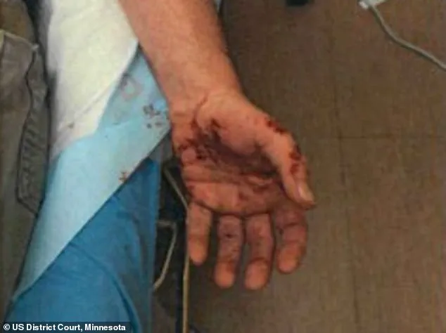 ICE Agent Involved in Fatal Shooting Discloses Scars from Previous Encounter in Court Testimony