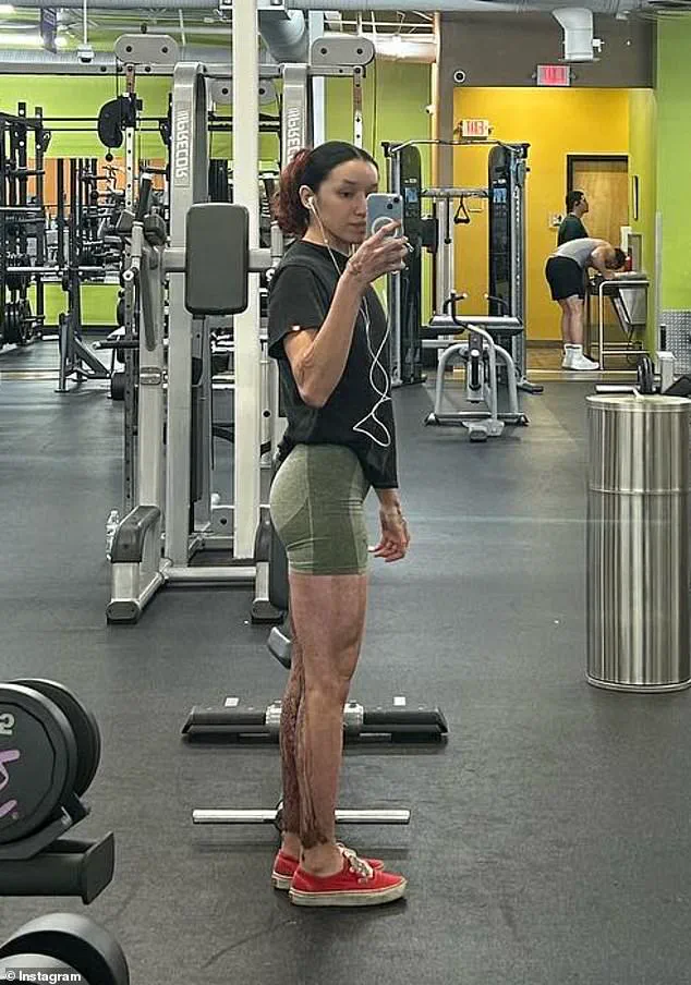 Bodybuilder Survives Shooting and Acid Attack in Hawaii, Suffering 30% Third-Degree Burns