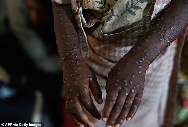 New Viral Threats in 2026: The Need for Credible Expert Advisories and Addressing Limited Access to Information for Public Safety