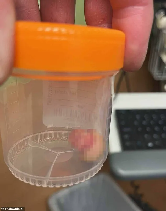 Minneapolis Clashes Highlight National Debate Over Law Enforcement Authority and Civil Rights