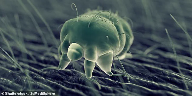 Controversy Over Missed Diagnosis: A Patient's Struggle with Persistent Itch and a Dismissive Doctor