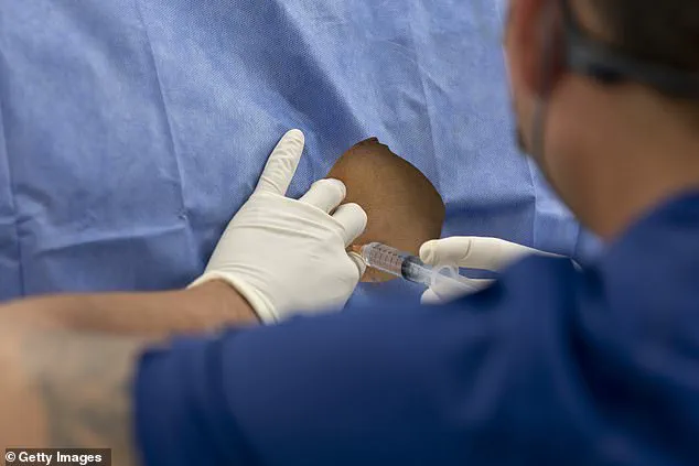 Antibiotic Gel Injection Offers Long-Lasting Relief for Chronic Back Pain, Study Suggests