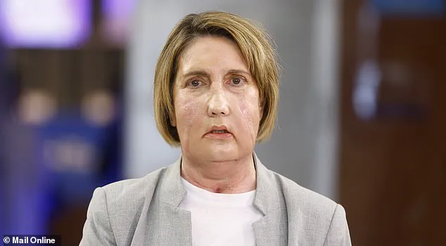 World's First Facial Transplant from Assisted Dying Donor Raises Ethical Questions