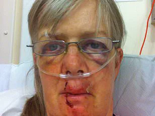 Firefighters Rescue Dog Walker After Hours-Long Standoff with Aggressive Cow on Isle of Wight