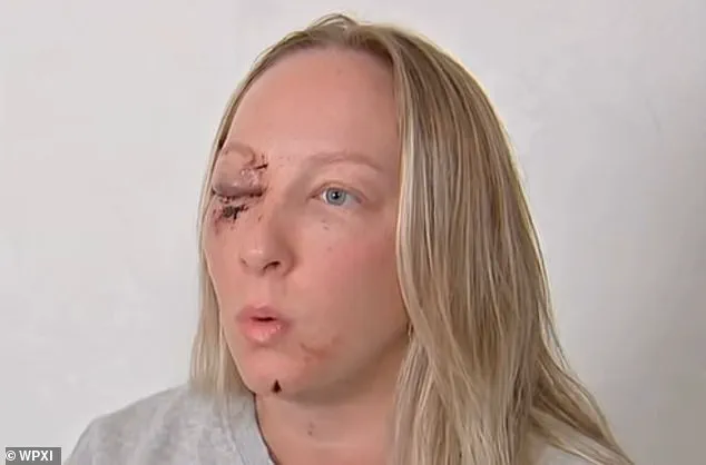 Ice Slab Shatters Windshield of Mother, Leaving Her and Daughter in Shock