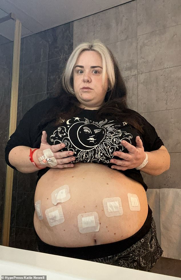 From 158kg to New Life: Katie Newell's NHS-Funded Gastric Bypass and Mental Health Journey