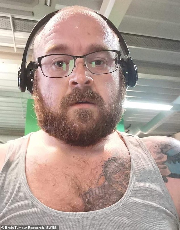 Hidden Brain Tumor Misdiagnosed as Hormonal Imbalance: A Father's Struggle with Glioblastoma