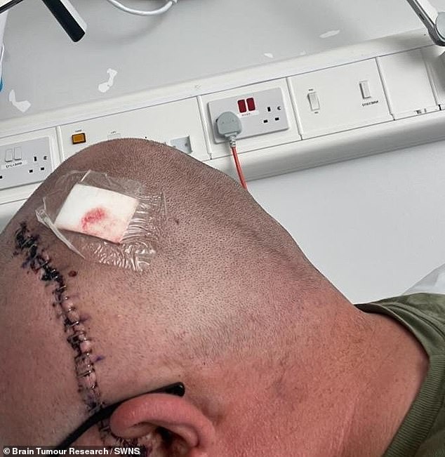 Hidden Brain Tumor Misdiagnosed as Hormonal Imbalance: A Father's Struggle with Glioblastoma