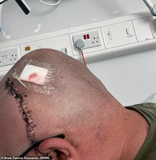 Hidden Brain Tumor Misdiagnosed as Hormonal Imbalance: A Father's Struggle with Glioblastoma