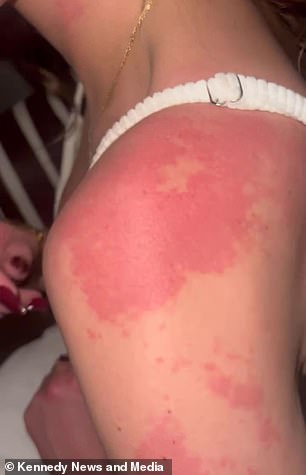 Mercedes Brooke's Hair Loss and the Alarming Symptoms That Followed