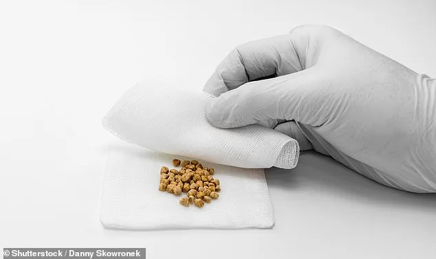 Landmark Study Reveals Cheese Intake Linked to 26% Lower Gallstone Risk