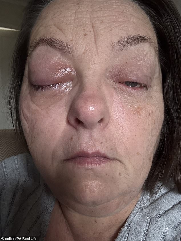 Tammy Jackson's Fight Against Rare Eye Cancer Fuels Her Mission to Promote Early Screenings