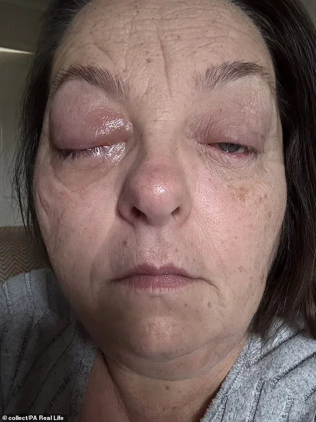 Tammy Jackson's Fight Against Rare Eye Cancer Fuels Her Mission to Promote Early Screenings