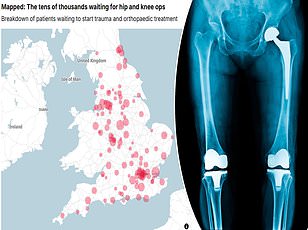 Innovative Smart Shoes Combat Falls Among UK's Elderly