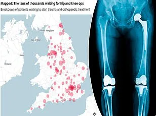 Innovative Smart Shoes Combat Falls Among UK's Elderly