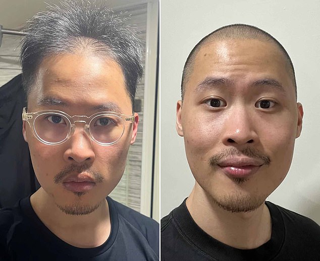 r/bald: Hair Loss to Confidence in a Supportive Online Community