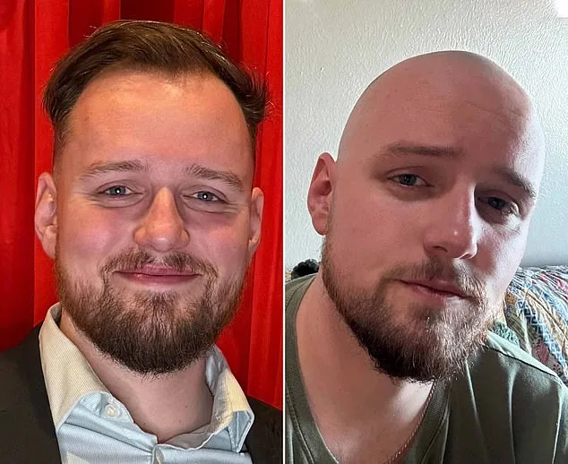 r/bald: Hair Loss to Confidence in a Supportive Online Community