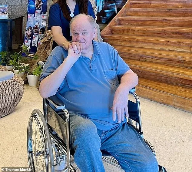 Thomas Markle Sr. Faces Prosthetic Journey as Daughter Meghan Remains Absent