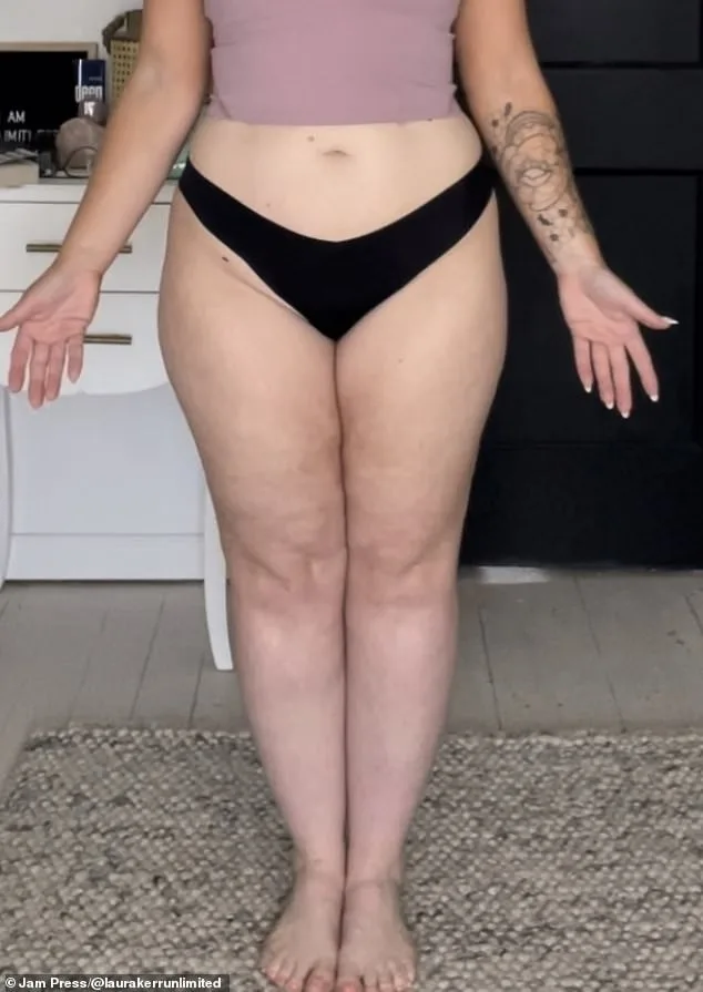From Isolation to Diagnosis: Laura Kerr's Journey with Lipedema
