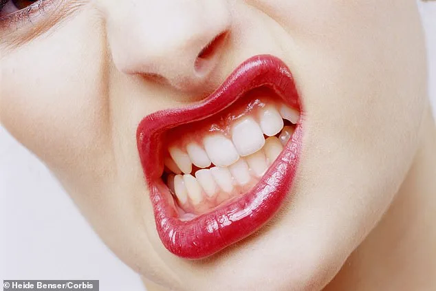 Bruxism: A Silent Culprit Behind Chronic Pain and Dental Damage
