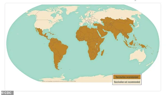 Typhoid Fever Resurges With Drug Resistance, Fueling Global Health Concerns