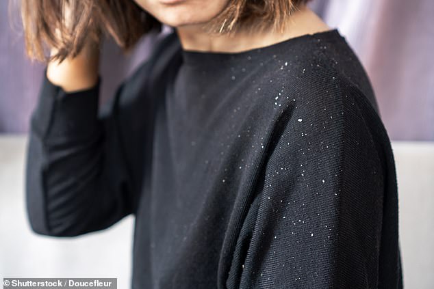 Dandruff Surge Linked to Scalp Microbiome Shifts and Environmental Changes, Raising Public Health Concerns