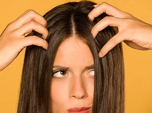 Dandruff Surge Linked to Scalp Microbiome Shifts and Environmental Changes, Raising Public Health Concerns