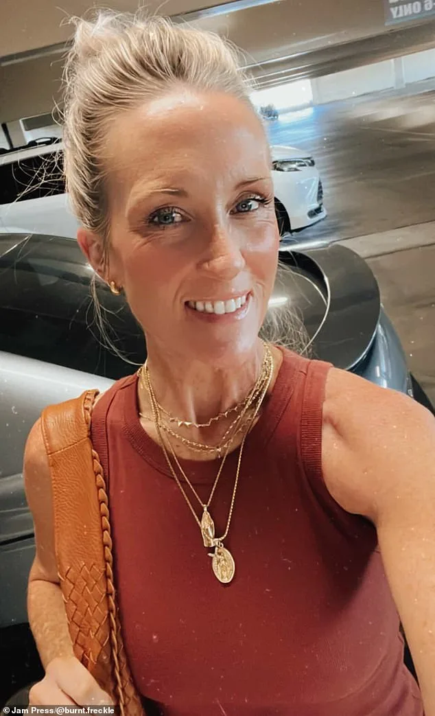 Kory Feltz's 20-Year Relentless Battle with Skin Cancer: From Calf to Lip, a Recurrence That Refuses to Fade