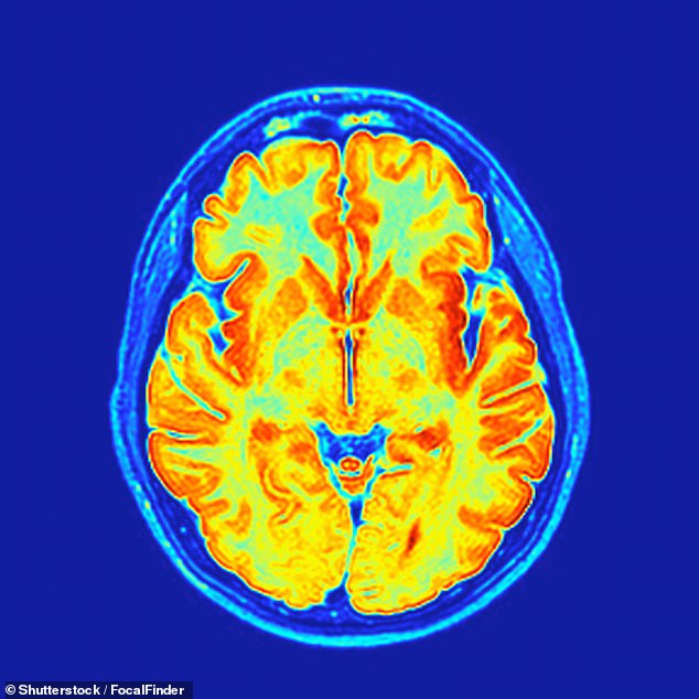 Pregnancy Triggers Neurological Transformation, Not Cognitive Decline: Study Challenges 'Baby Brain' Myth