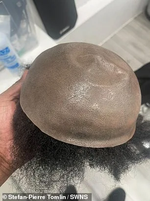 Unveiling 'Mr Tinder': How a Hair Transplant Ended a 20-Year Secret