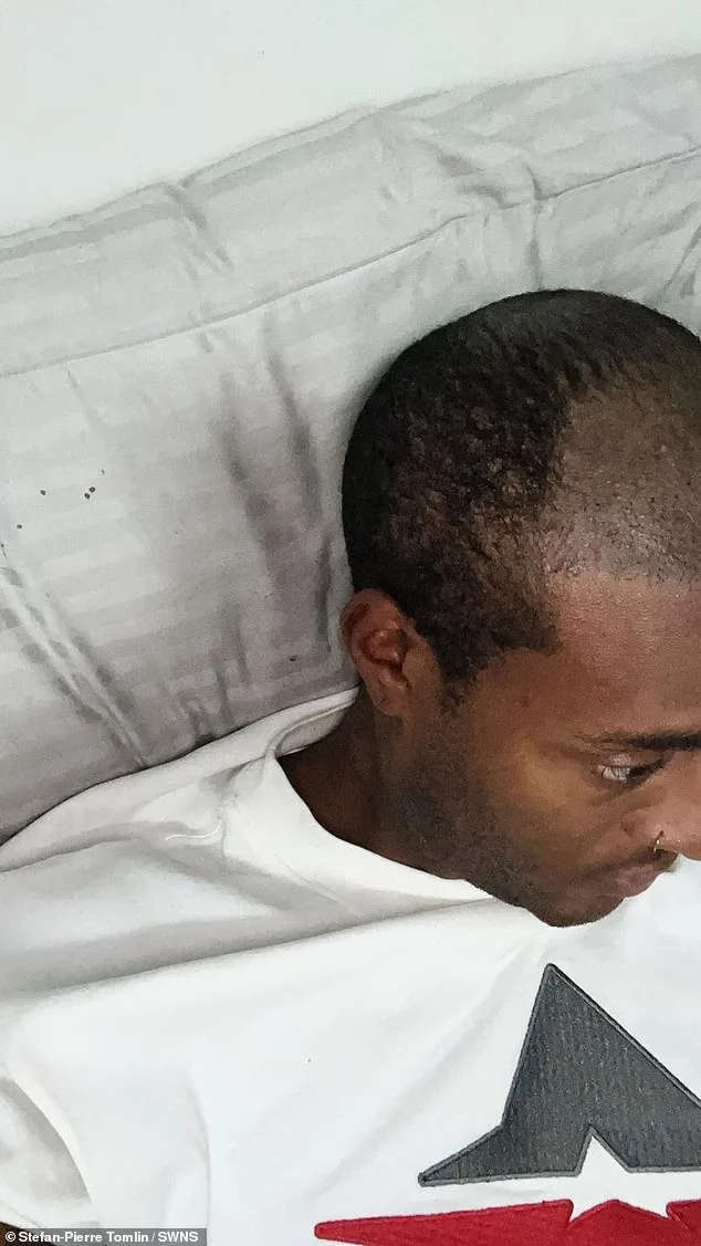 Unveiling 'Mr Tinder': How a Hair Transplant Ended a 20-Year Secret