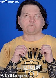 Drowsy Driving Crash Leaves Joseph DiMeo with Severe Burns and Coma