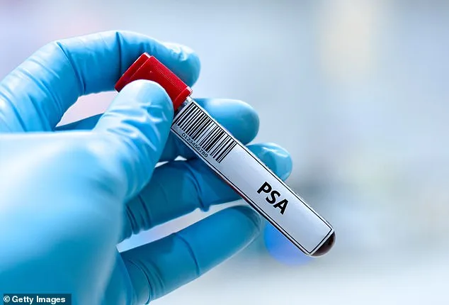 Prostate Cancer Screenings Match Breast in Effectiveness, Challenging Health Policies