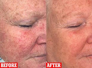 More Than Just a Rash: The Profound Impact of Underestimated Skin Conditions